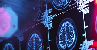 photo of brain scan